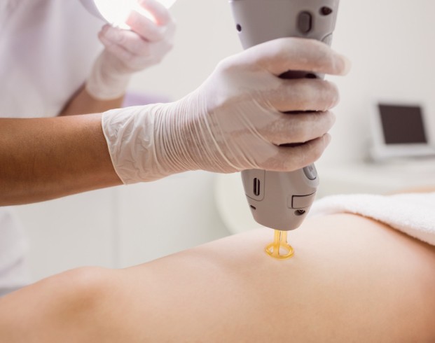 Hair Laser Removal