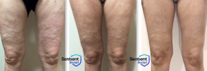 Procedure Special Image