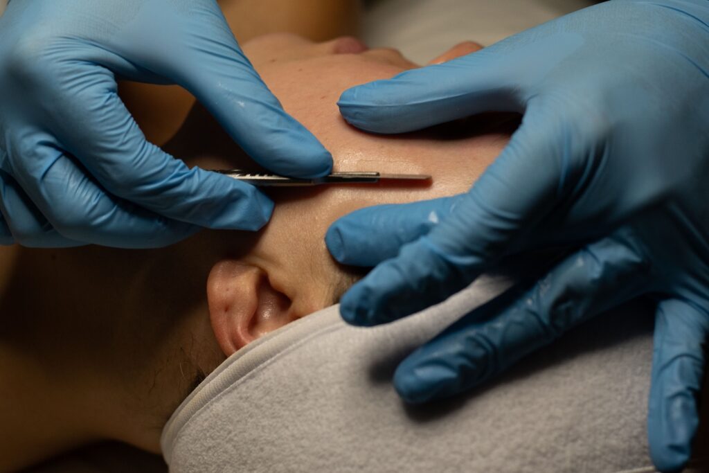 gloved hands holding a surgical blade against a woman’s forehead during a dermaplaning treatment