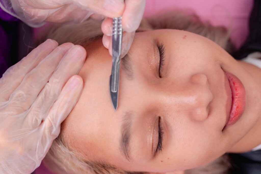 gloved hands holding a surgical blade at the center of a woman’s forehead during a dermaplaning procedure