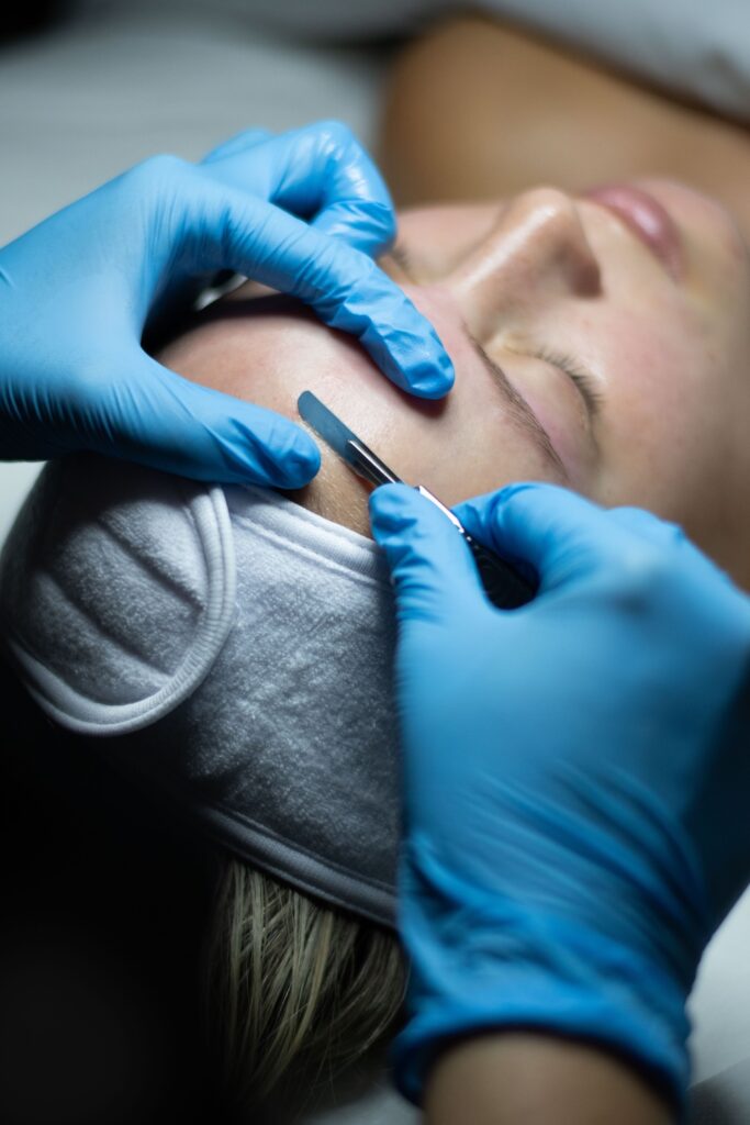 blue-gloved hands using a dermaplaning blade on a woman’s cheek as she lies on a treatment bed