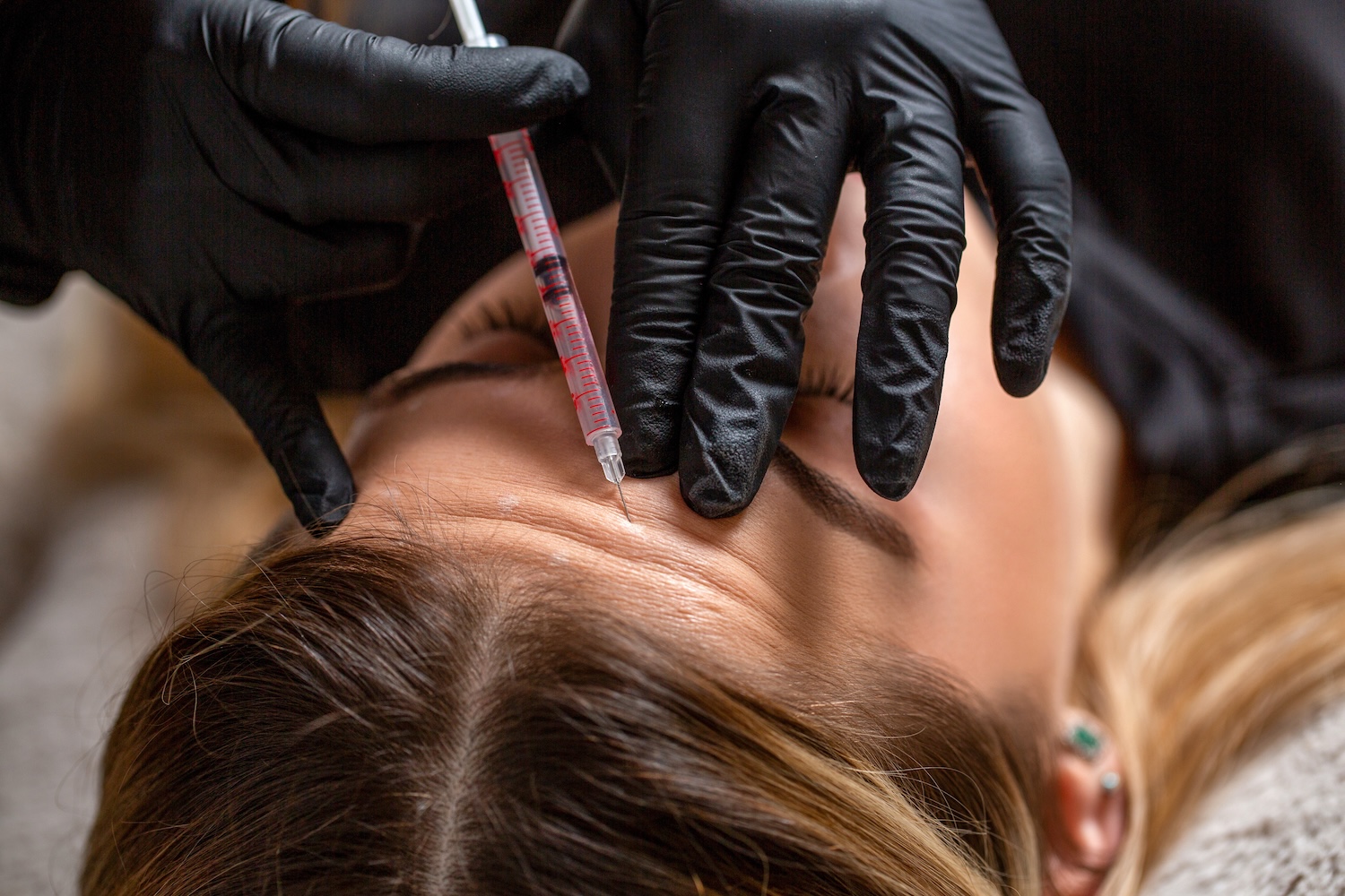 gloved hands holding a syringe injecting the center of a person’s forehead