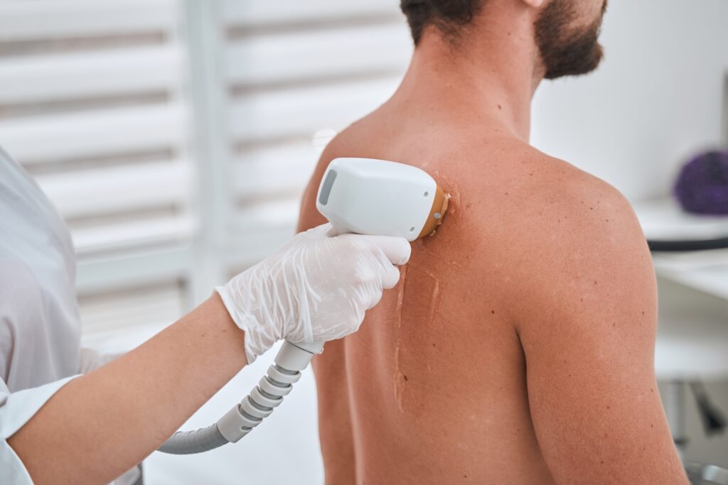 Gloved technician using a handheld laser device on a man's upper back.