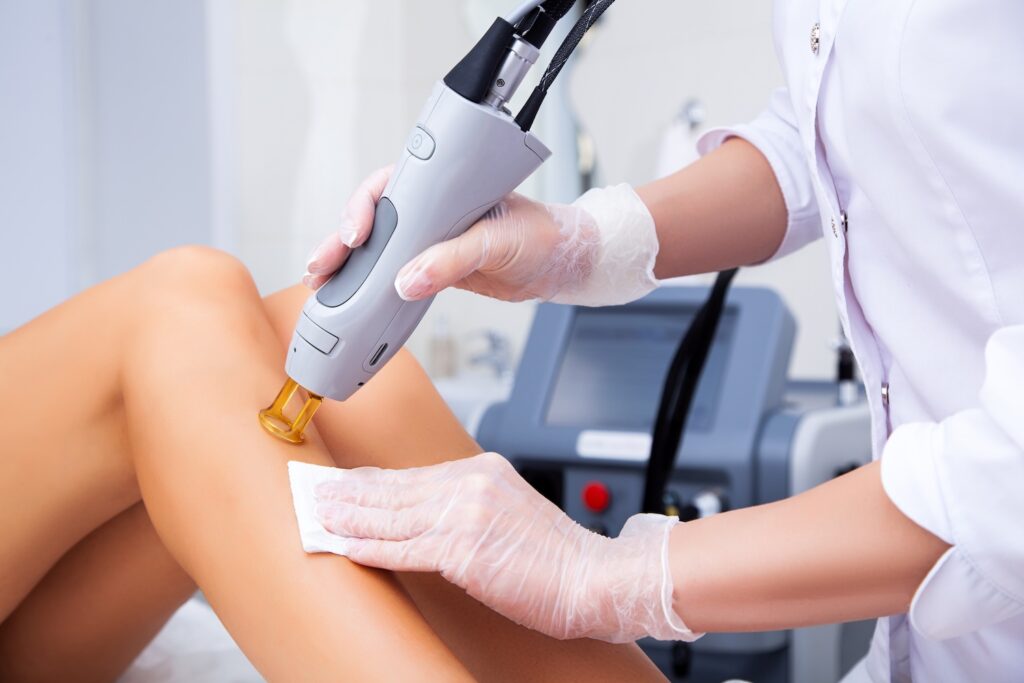 close-up of a technician performing laser hair removal on a woman's legs with a handheld device in a clinic