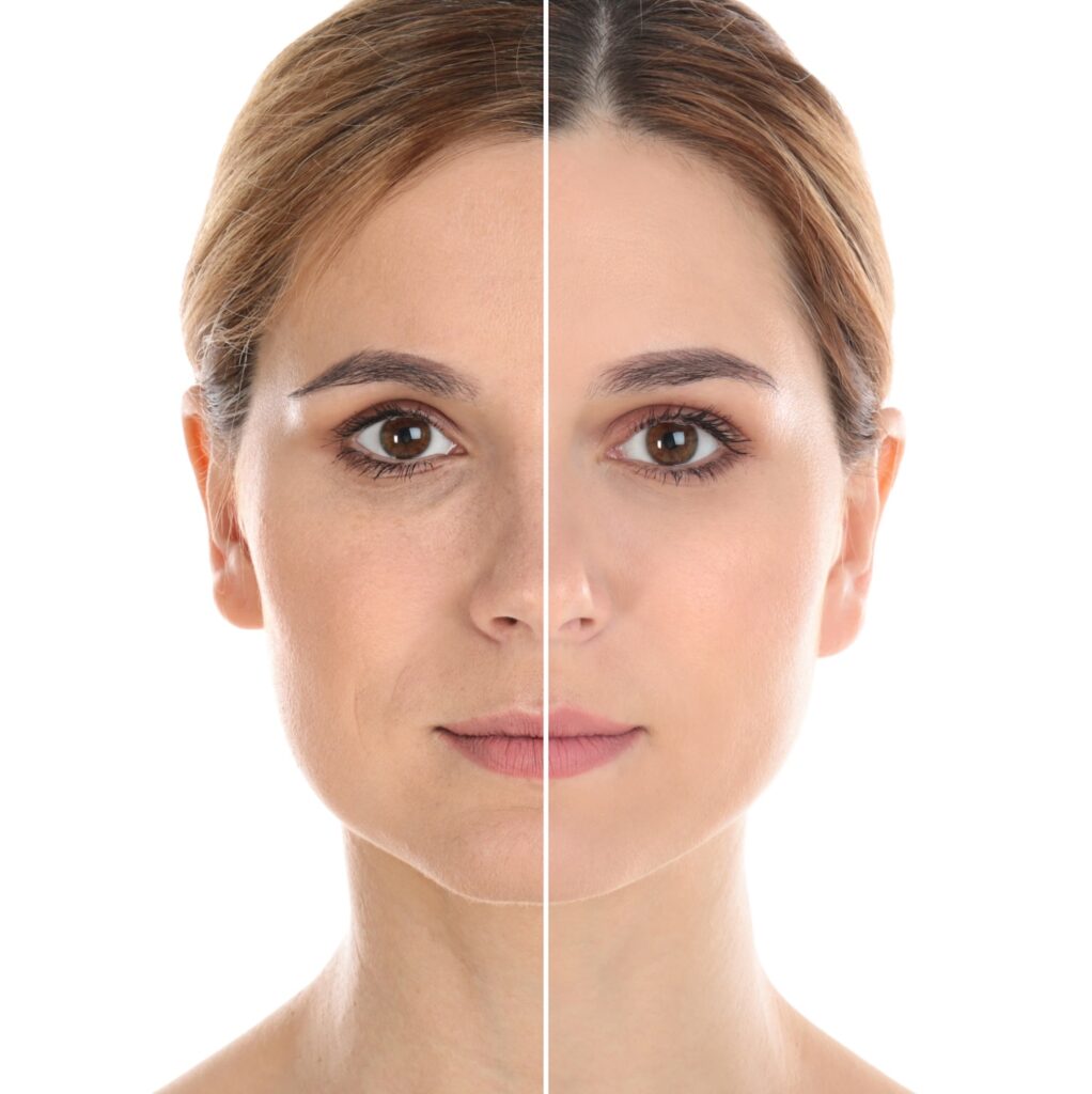 Woman’s face shown in a split view, with each half displaying different skin appearance.