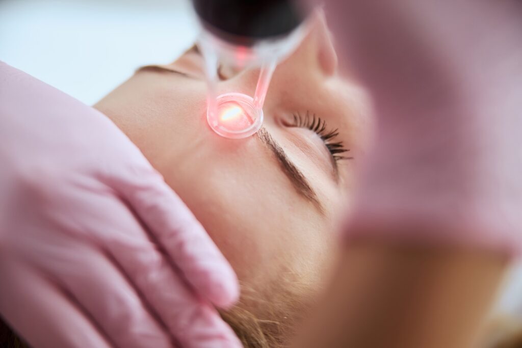 close-up of a laser device emitting a red light onto the skin between a person’s eyebrows