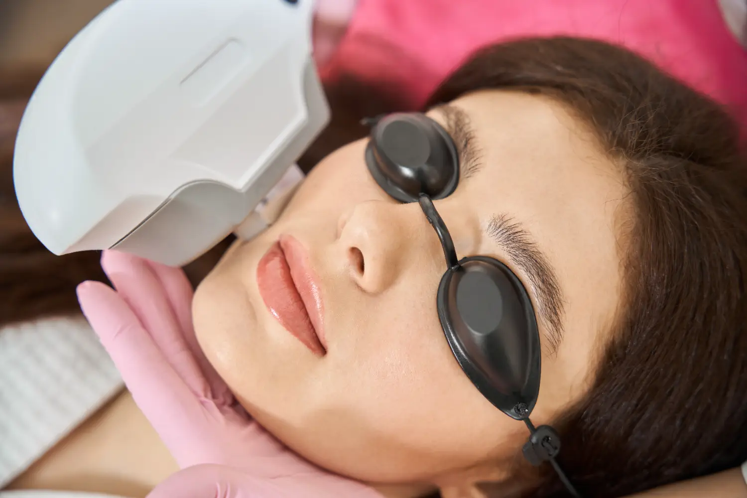 Patient wearing protective eye shields while receiving an IPL photofacial treatment.