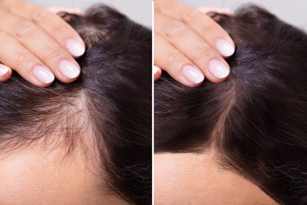 side-by-side view of scalp hair part showing wider part on left and narrower part on right