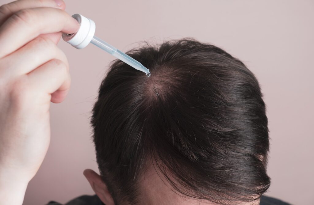 Dropper releasing liquid onto the top of a person’s scalp with hair parted to expose the skin