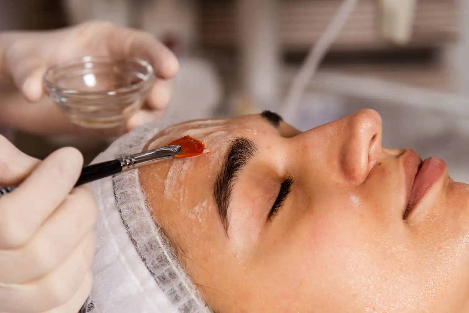 A gloved hand uses a brush to apply a translucent solution to a woman’s forehead while she rests with eyes closed.