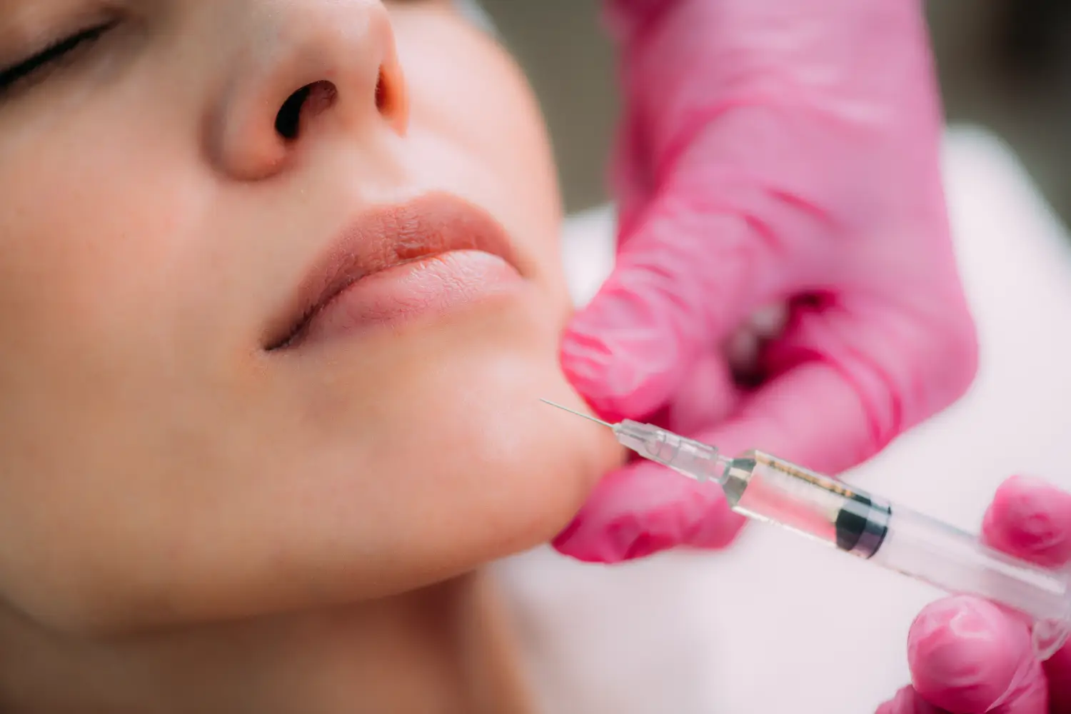 Close-up of a syringe being injected into a woman’s chin while a person wearing pink gloves steadies her face.