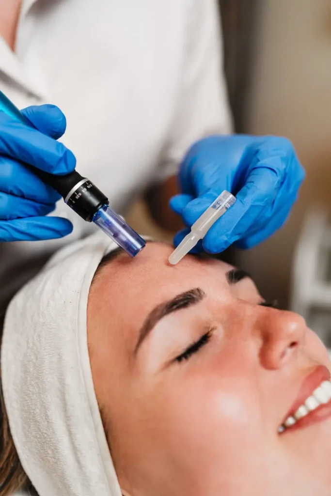 Person lying down with eyes closed while gloved hands hold a microneedling device and a serum vial above the forehead
