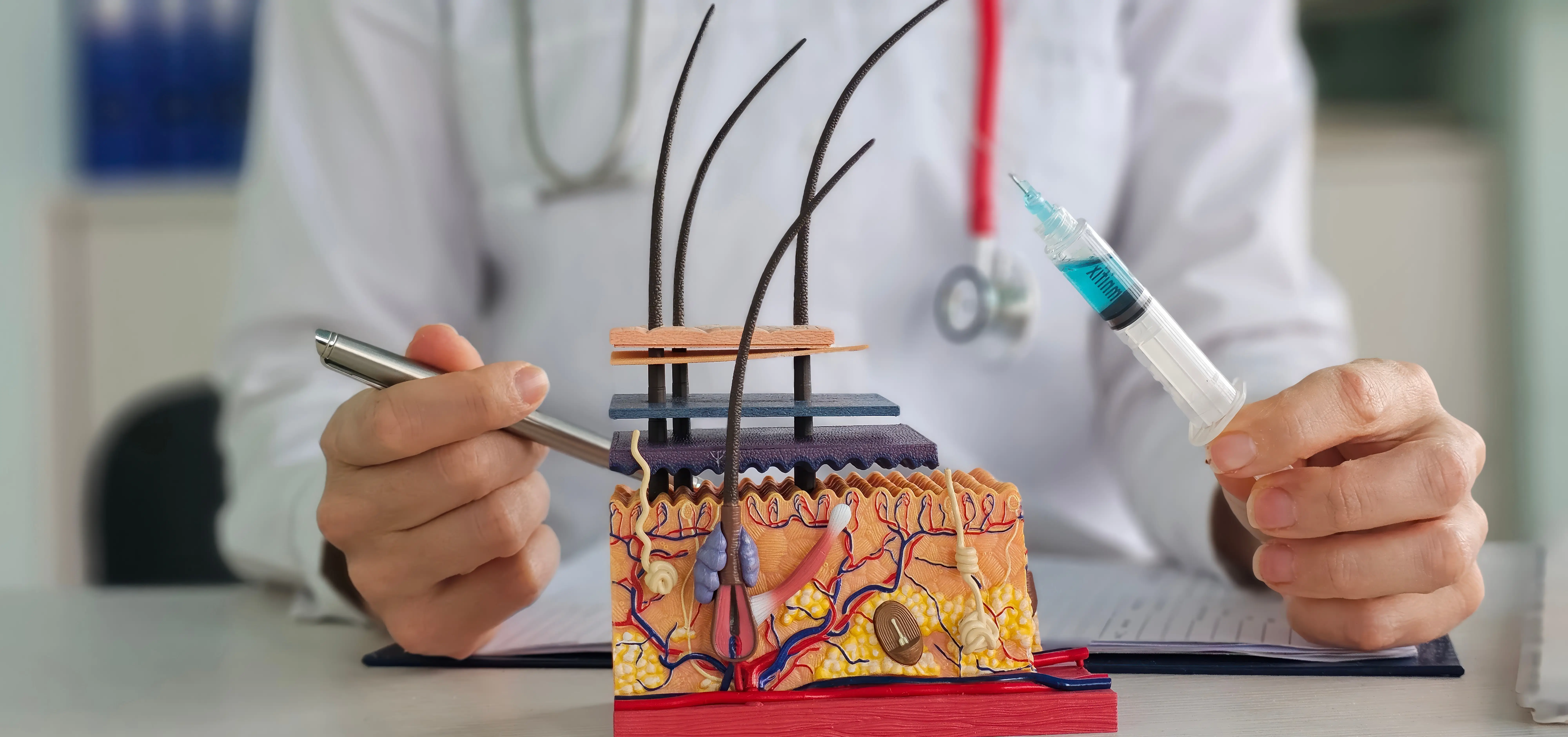 Healthcare provider holding syringe beside scalp and hair follicle model
