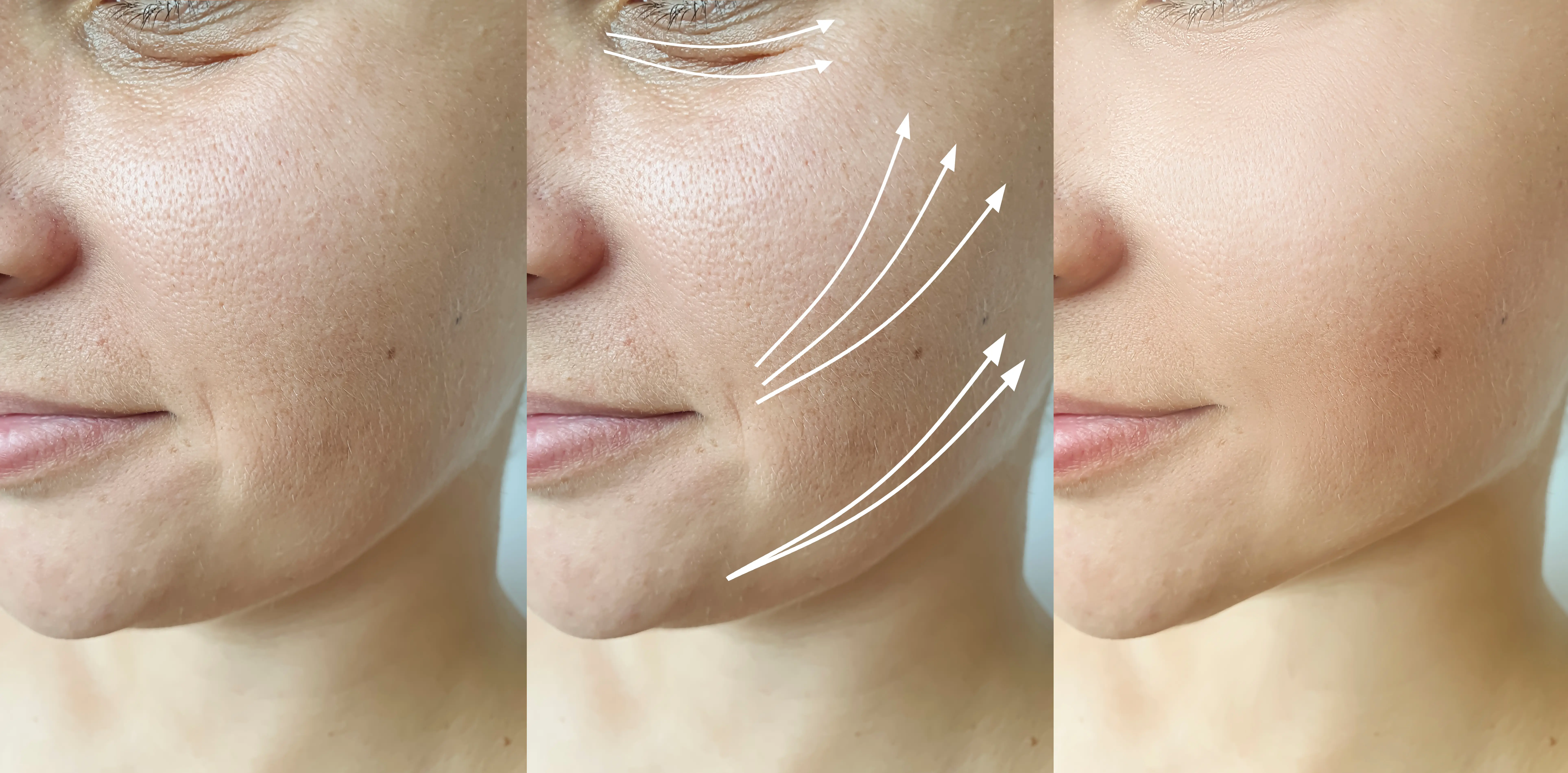 Three side-by-side facial close-ups with center arrows and visible differences in skin texture and fine lines