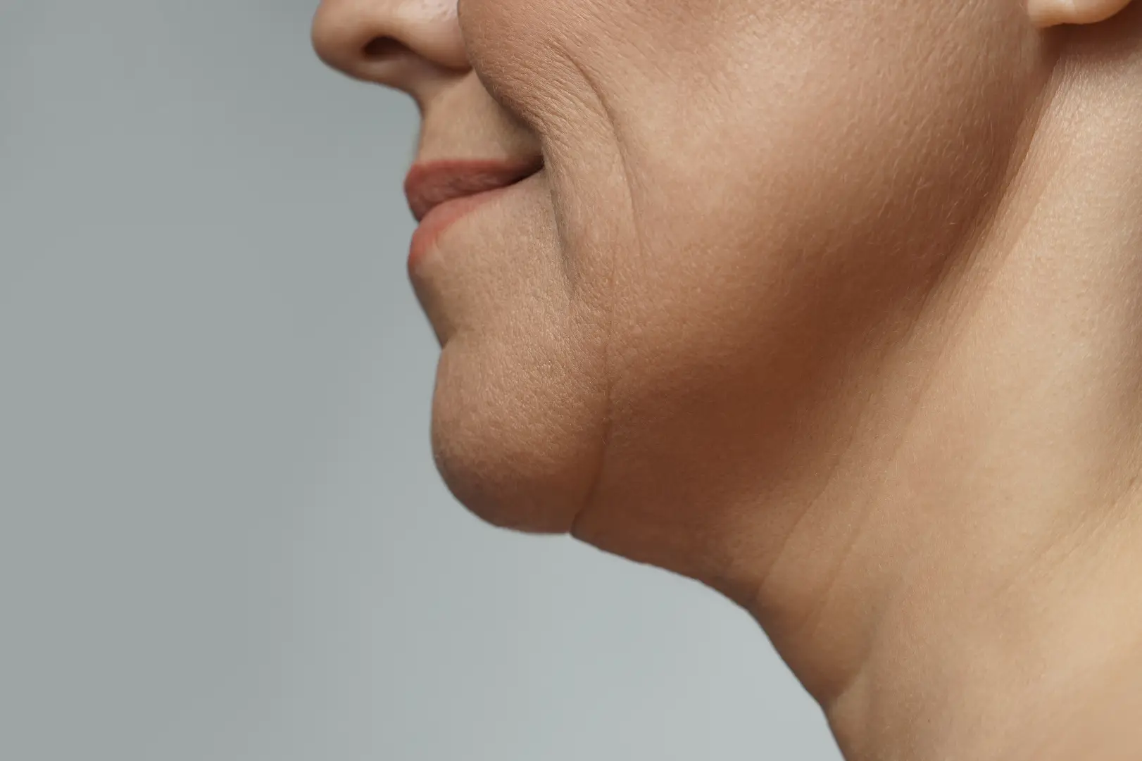 Side close-up of the lower face and neck showing folds and loose skin beneath the chin.