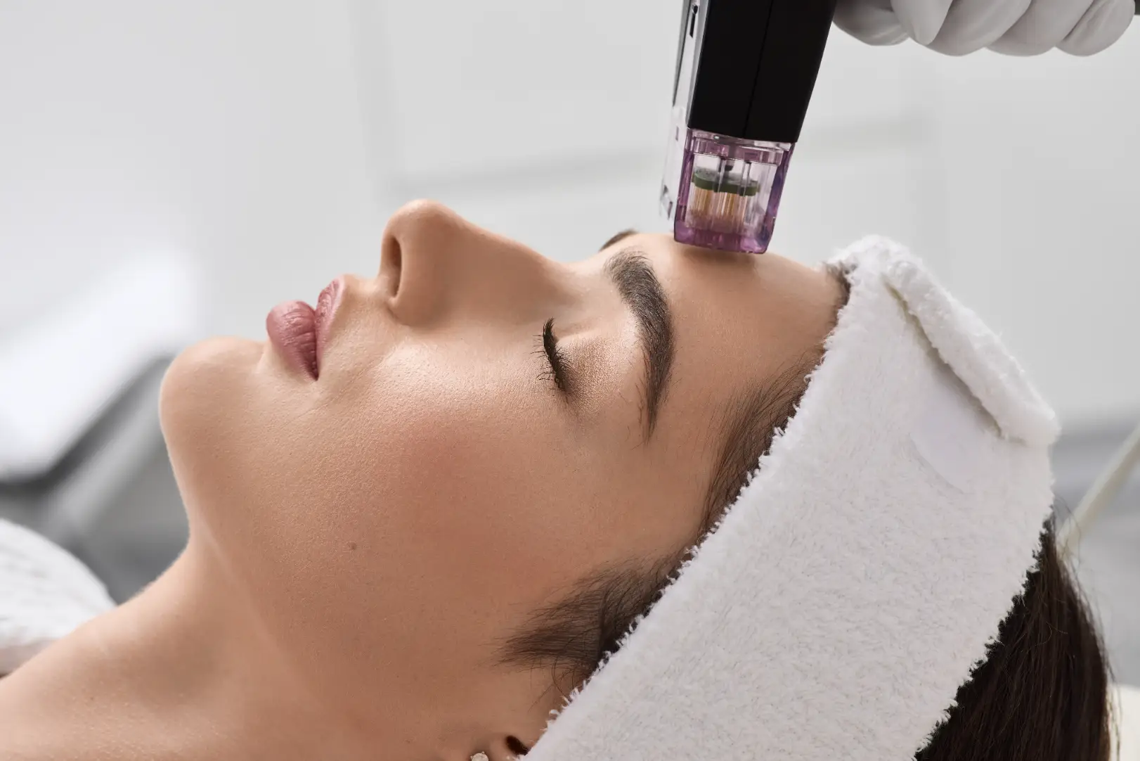 Handheld microneedling device positioned against a reclining woman's forehead during a facial treatment.