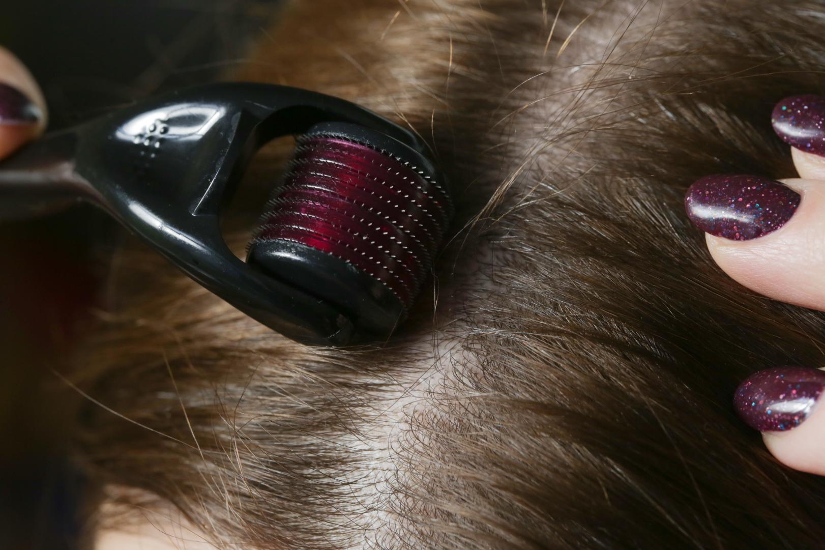 Close-up of a microneedling roller positioned against a parted section of brown hair and visible scalp.